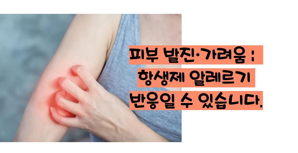 항생제 부작용