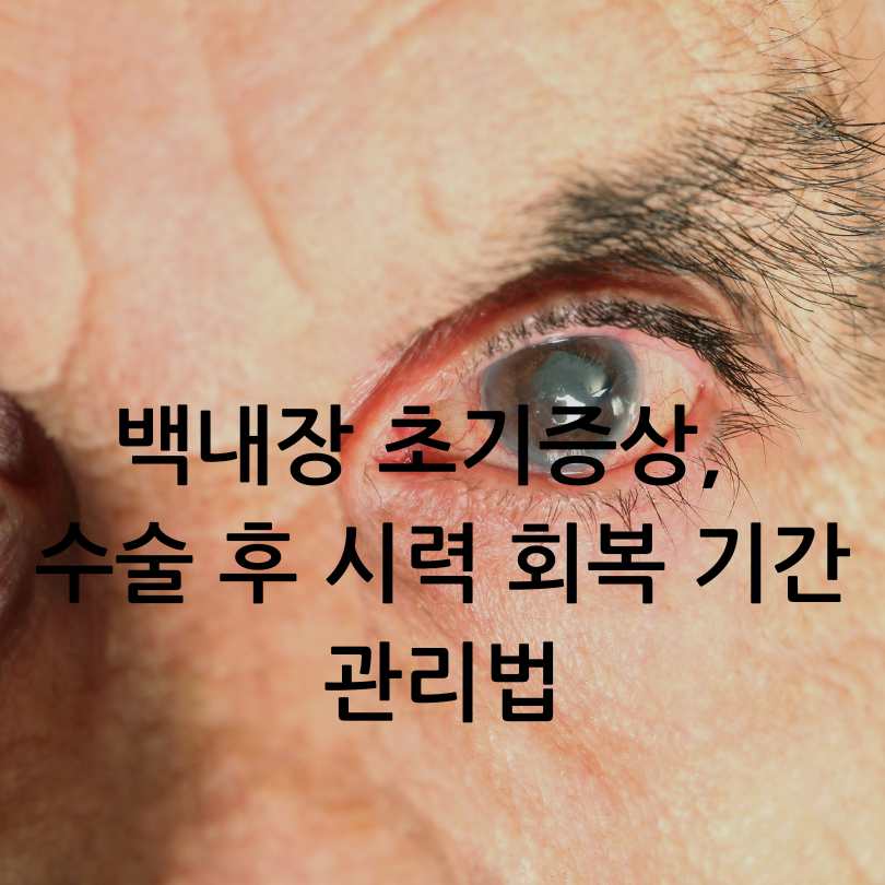 백내장 초기증상