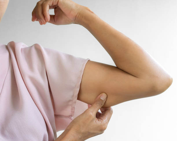 운동만으로 부족하다? 셀룰라이트 없애는 진짜 핵심 원인과 해결법