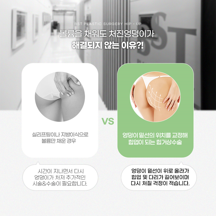 실리프팅이나 지방이식으로 볼륨만 채운 경우 시간이 지나면서 다시 엉덩이가 처져 추가적인 시술이나 수술이 필요할 수도 있습니다.