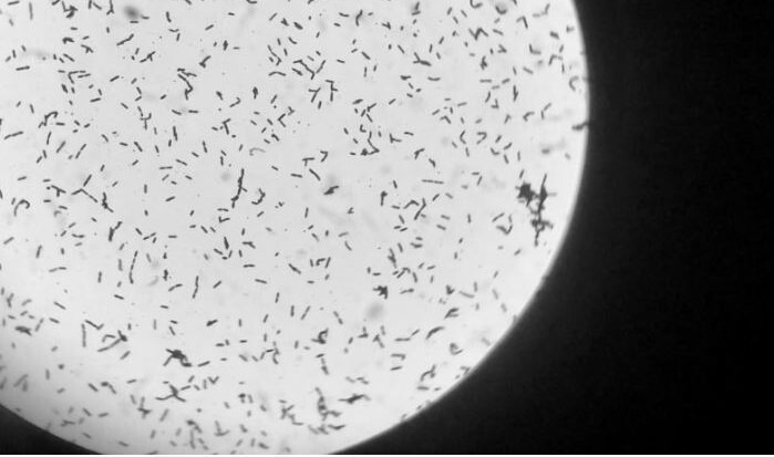 장내 미생물의 미세한 모습