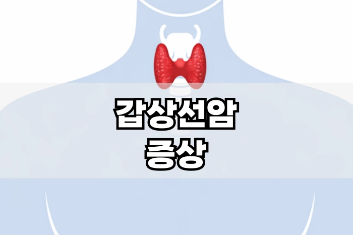 갑상선암 증상