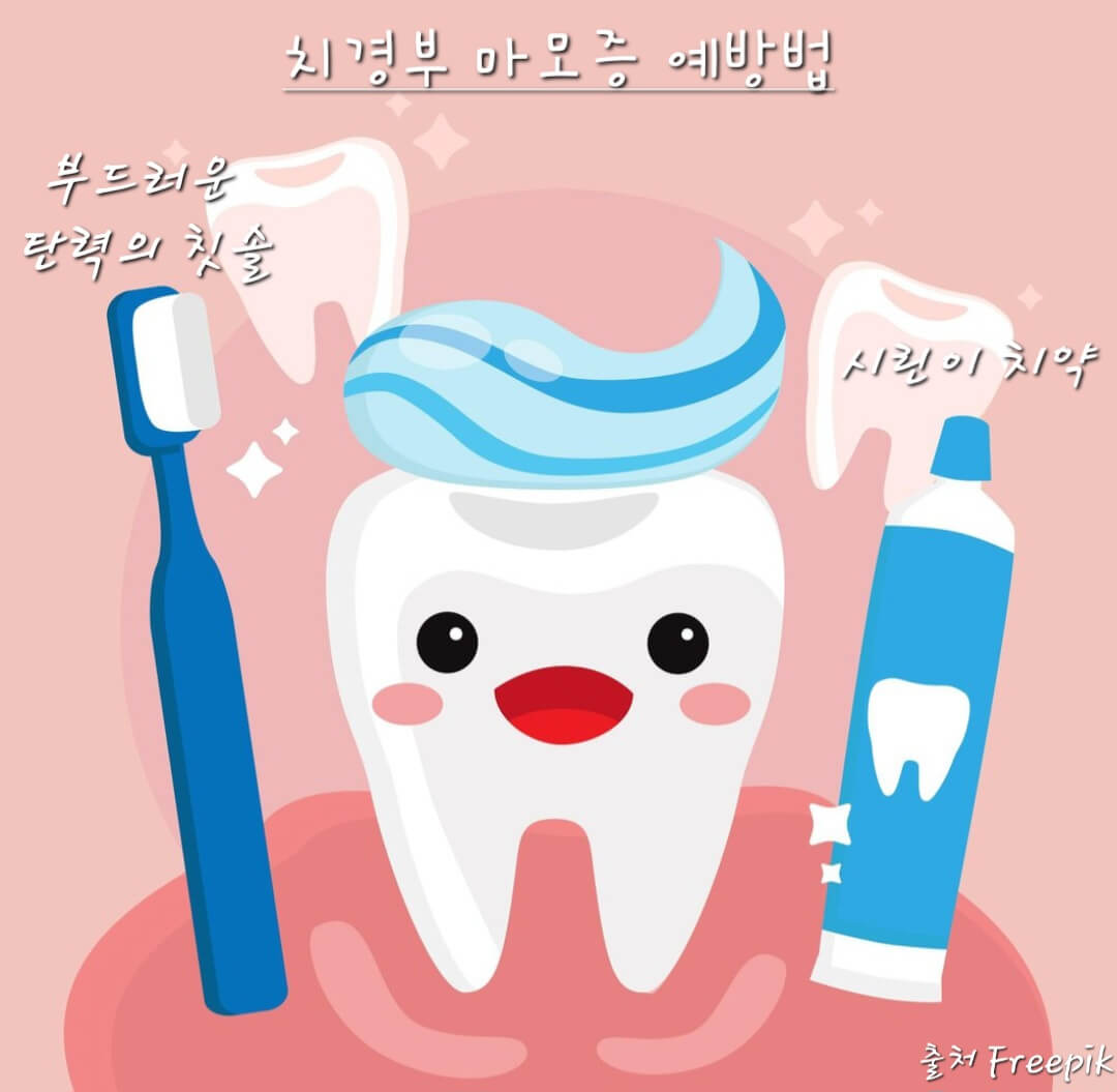 치경부마모증예방