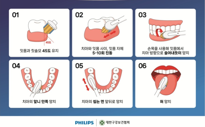 전동칫솔 사용법