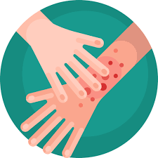 몸이 가려운 이유