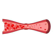 콜레스테롤 낮추는 방법 10가지