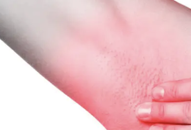 간수치가 높으면 나타나는 증상 34