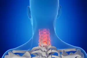 목디스크-수술비용