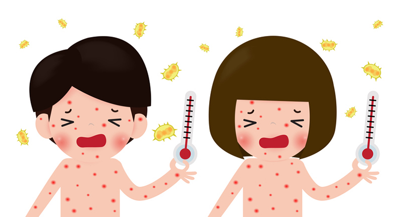 수족구 증상 및 치료 총정리 (성인 수족구&amp;#44; 유아 수족구)