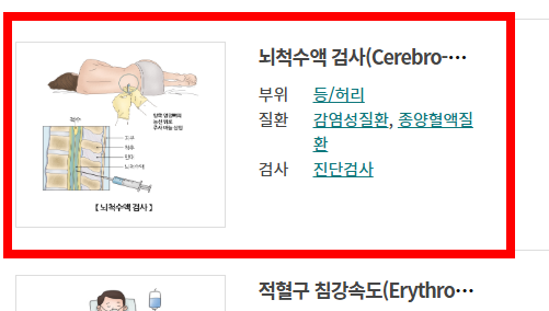 신장 검사방법 알아보기