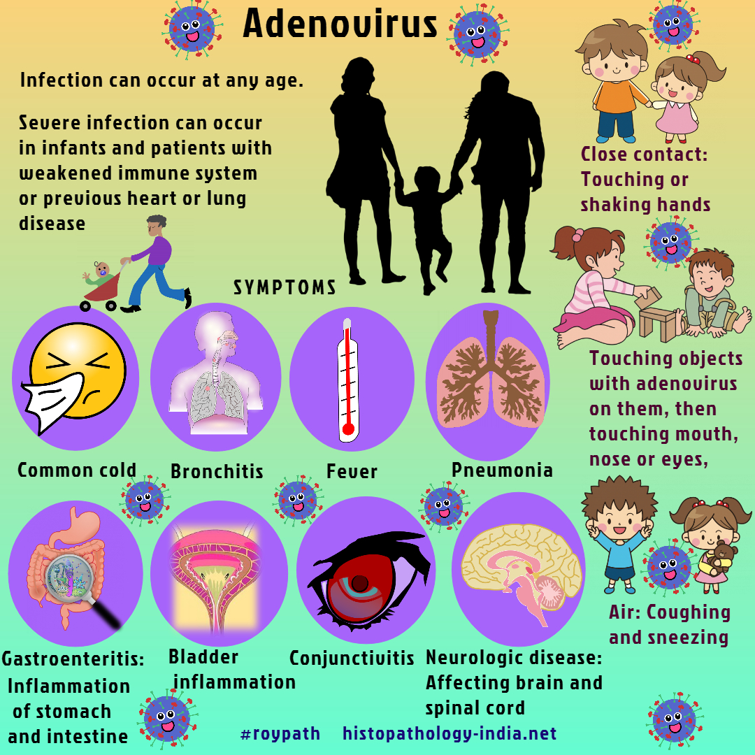 아데노바이러스증상
