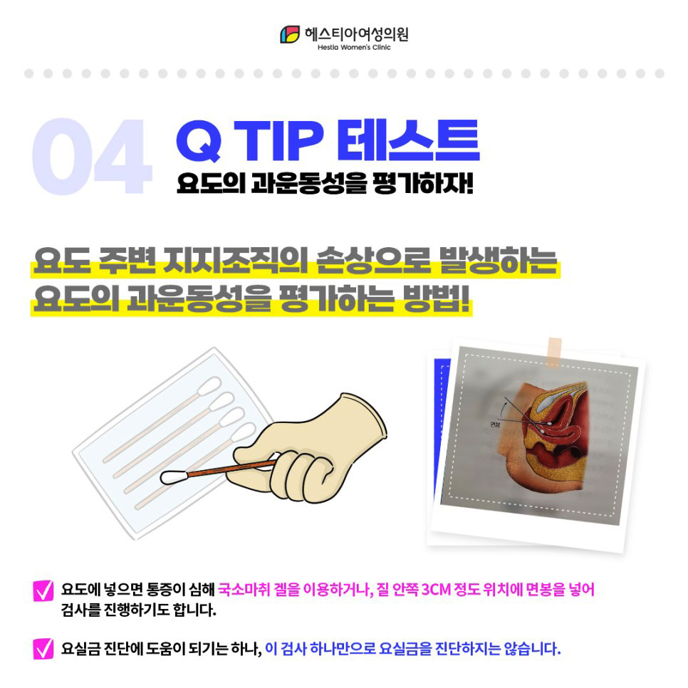 요실금진단Qtip테스트