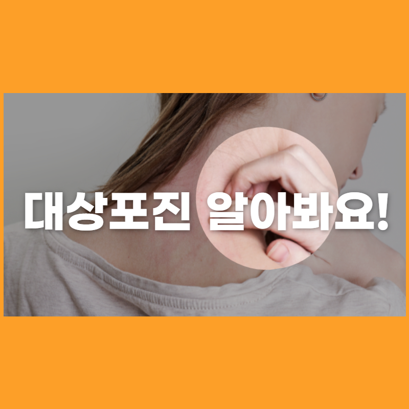 대상포진 썸네일