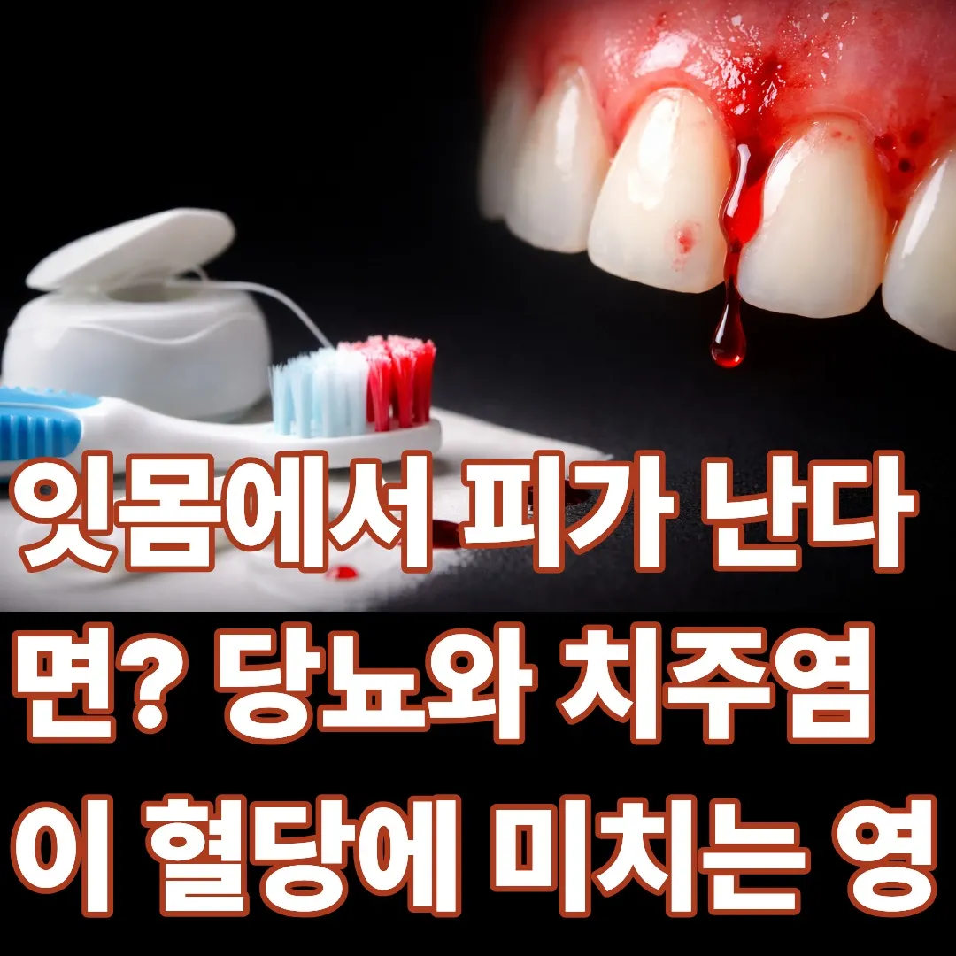 잇몸에서 피가 난다면? 당뇨와 치주염이 혈당에 미치는 영향