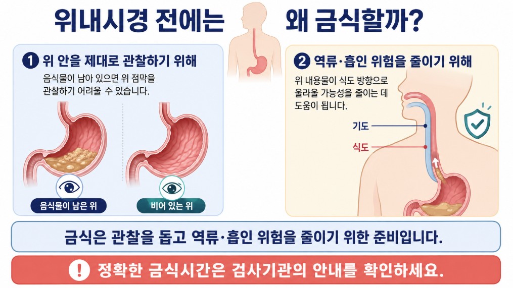 위내시경 검사 전 금식이 위 안의 음식물을 줄여 관찰을 돕고 위 내용물의 역류와 흡인 위험을 줄이는 데 필요한 이유를 설명한 이미지
