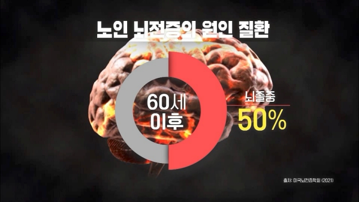 뇌전증