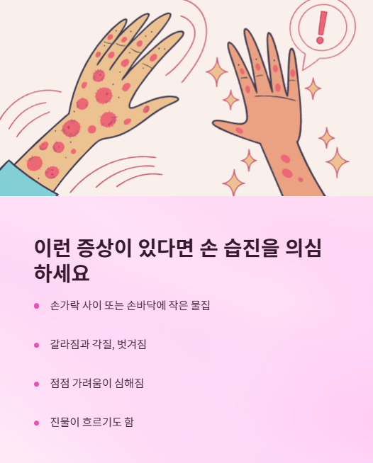 이런 증상이 있다면 손 습진을 위심 하세요