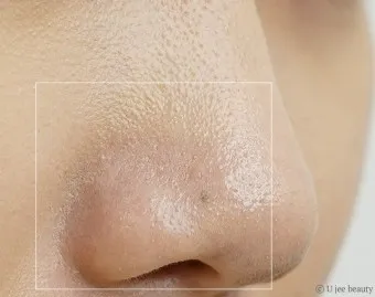 남자 얼굴 피지 제거 화장품 꿀템_2