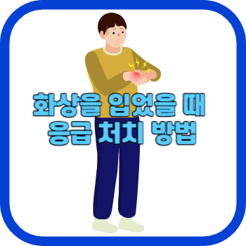 화상을 입었을 때 응급 처치 방법