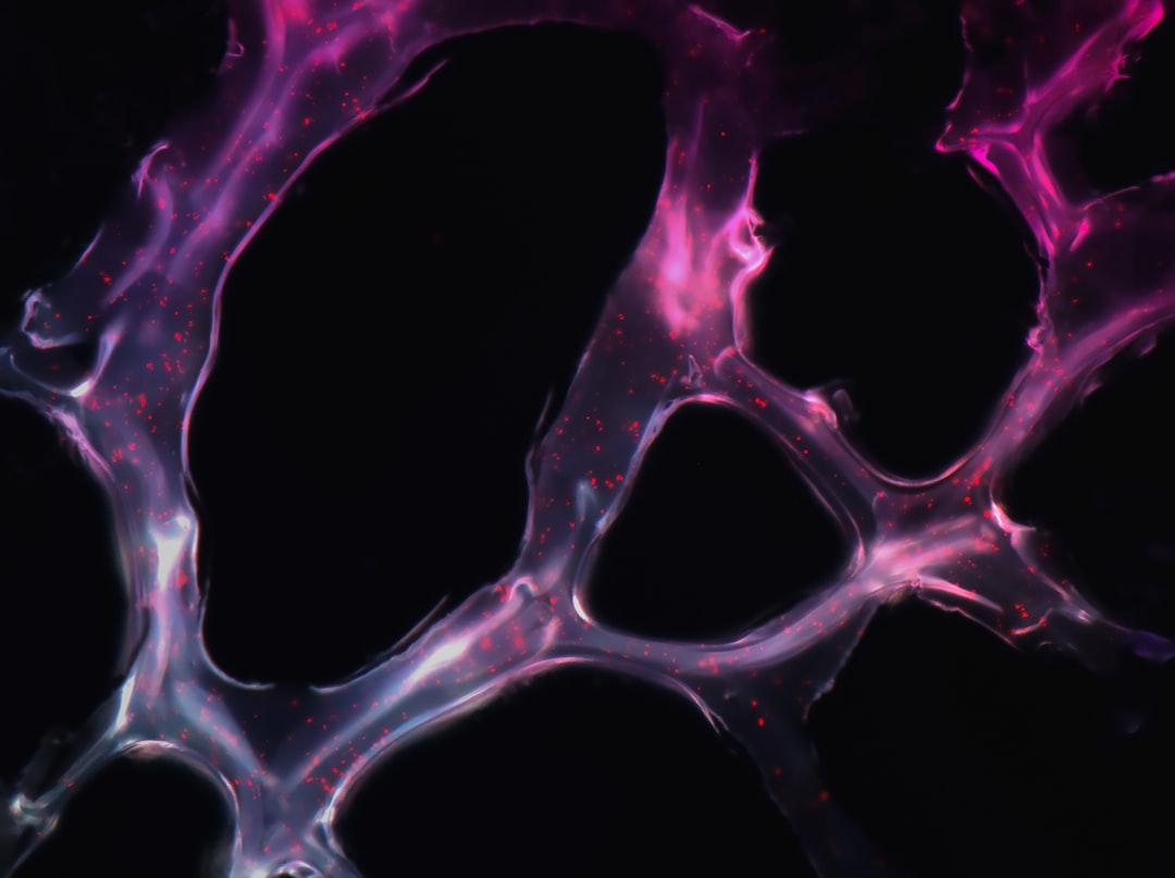 Nerve