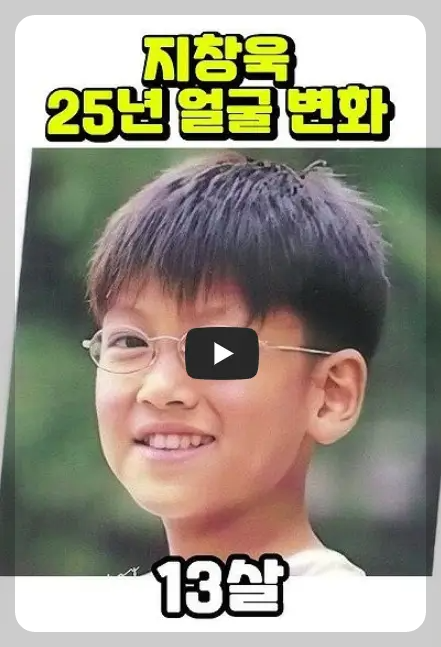 지창욱 얼굴 변화