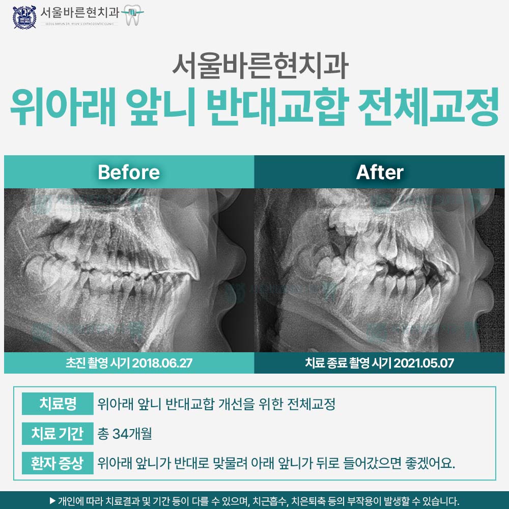 해운대교정치과