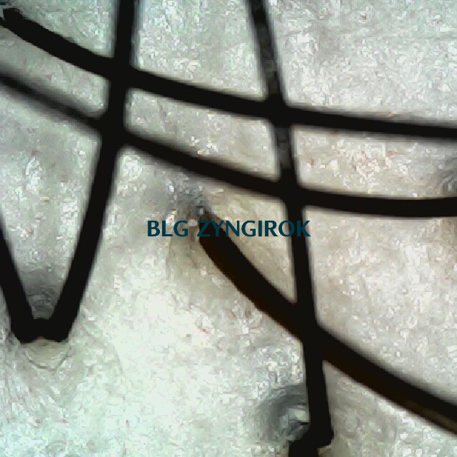 피나모아 복용 26주차 뒷머리 두피모습이다.