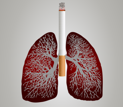 조기 발견이 중요한 암 관련 이미지