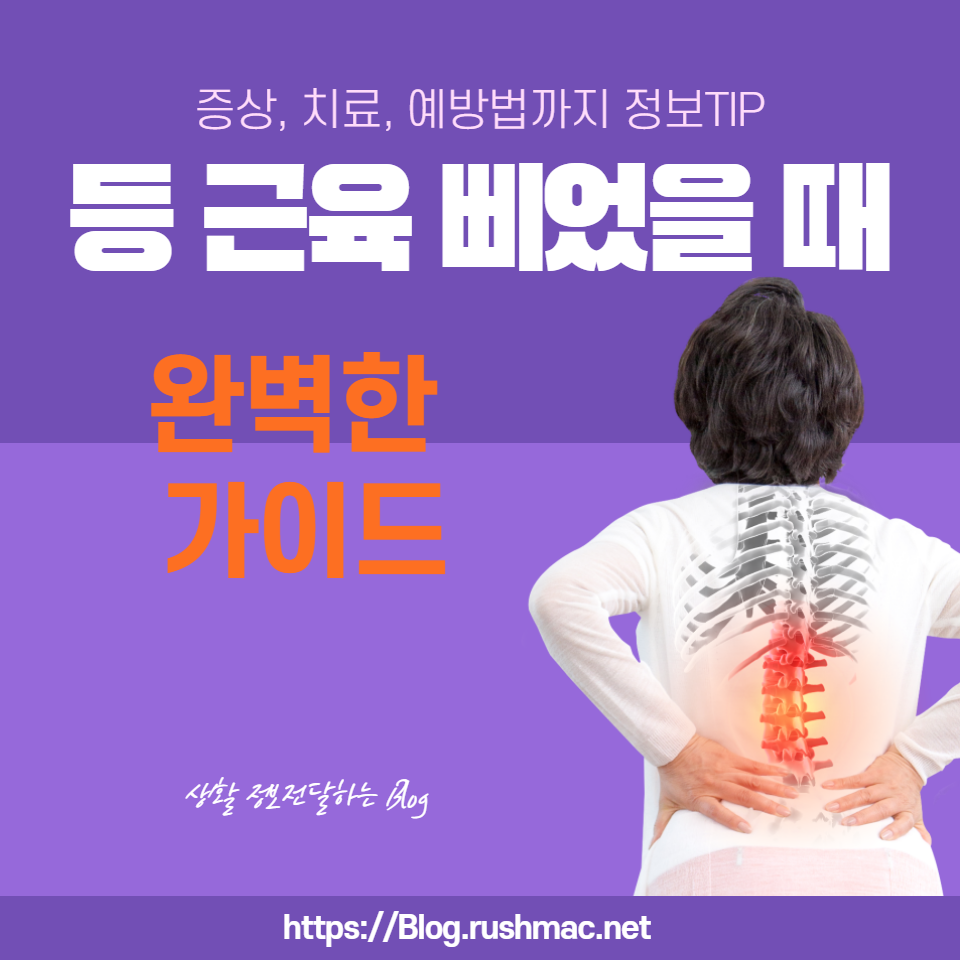 등 근육 삐염에 대한 완벽한 가이드