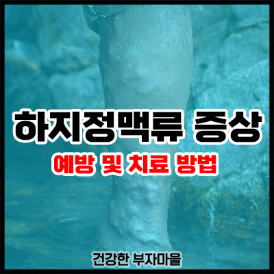 하지정맥류 증상