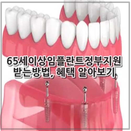65세이상임플란트정부지원 받는방법, 혜택 알아보기