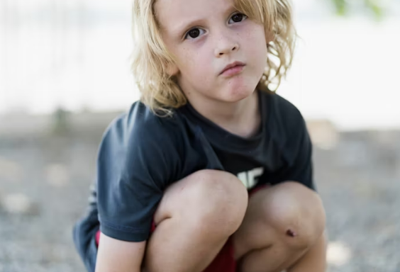 근막구획증후군 신속 치료 골든타임