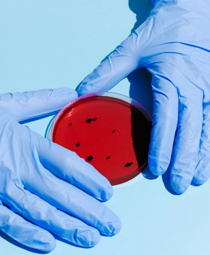 연쇄구균독성쇼크증후군