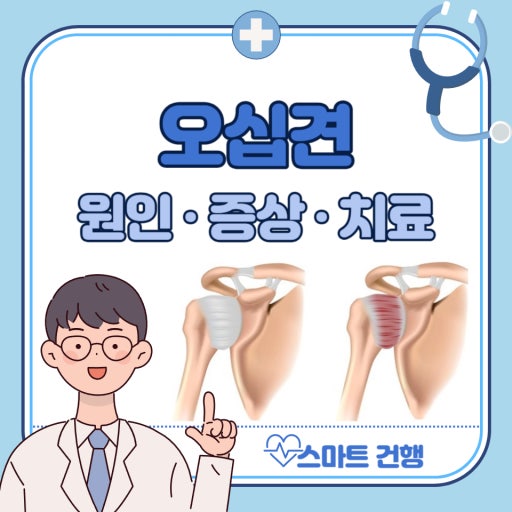 오십견 원인 증상 치료