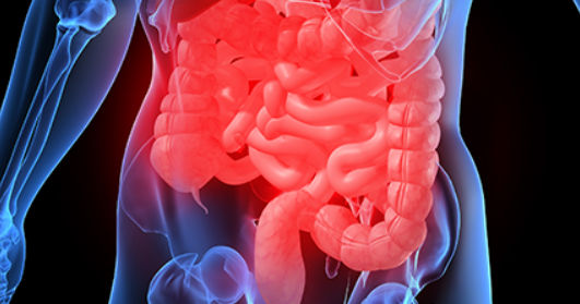 대장암관련 사진