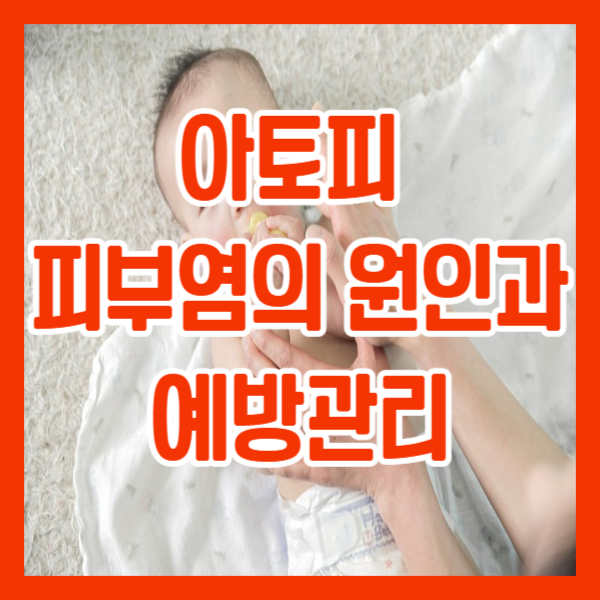 아토피 피부염의 원인과 예방관리