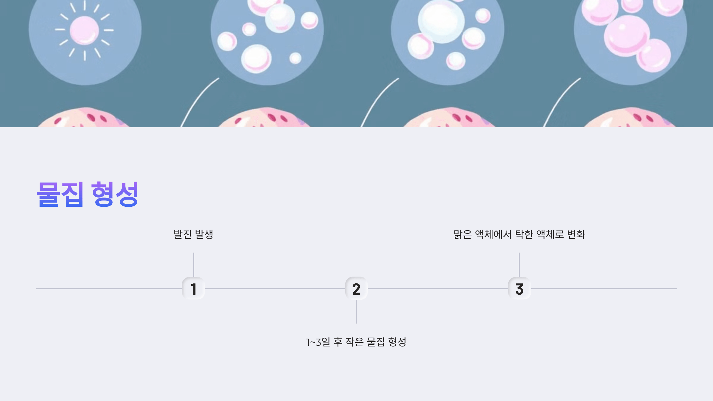 대상포진과 관련된 사진입니다.