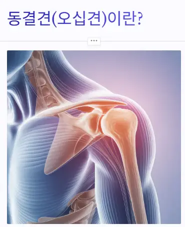 동결견 오십견