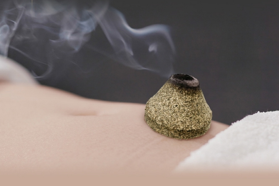 환자가 누워서 배를 열어둔 상태에서 뜸봉을 배꼽 밑에 부분에 놓아두고 불을 붙여서 타 들어가며 연기가 나고 있는 것을 확대를 하여 찍은 사진