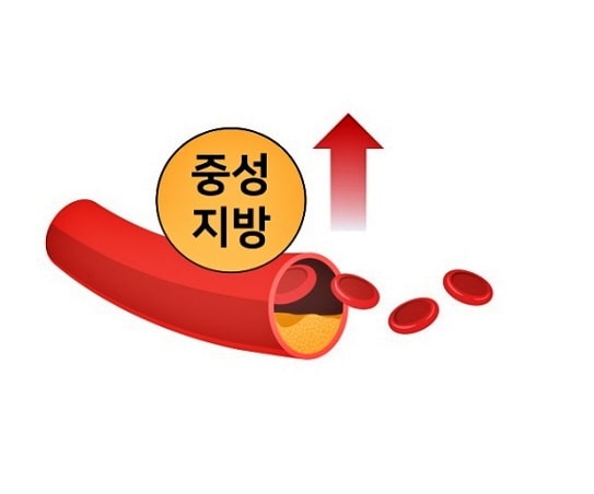 중성지방이-높은-이유