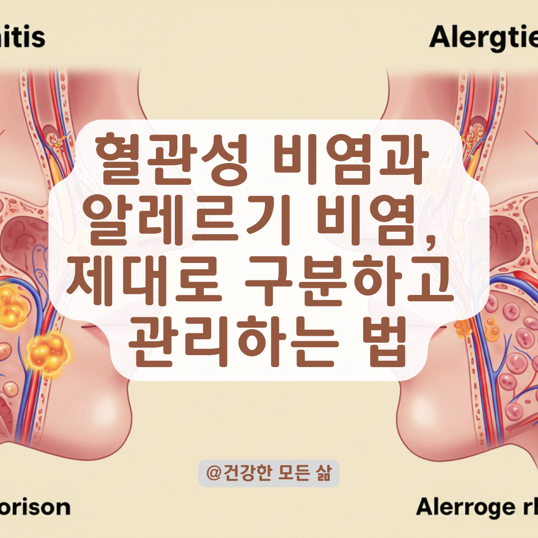 혈관성 비염과 알레르기 비염, 증상 구분과 치료 방향 정리.