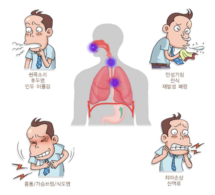 역류성식도염 증상