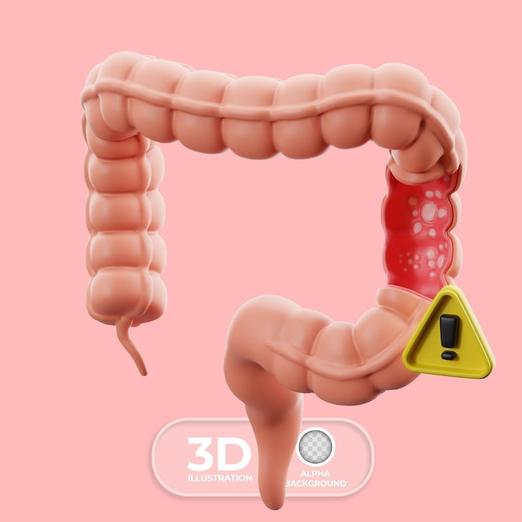 대장내시경 비용