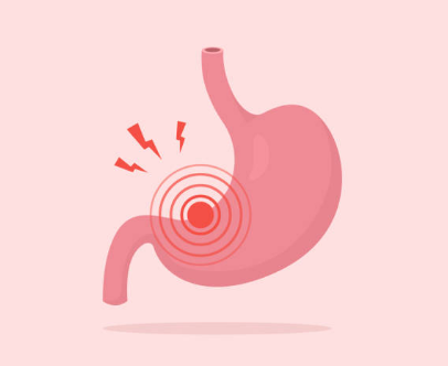 위암 초기증상, 수술비용, 수술후 회복기간 총정리 (2024ver)