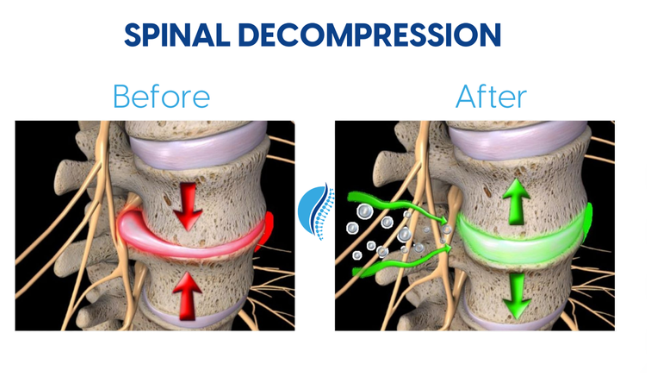신장분리치료 전후 비교