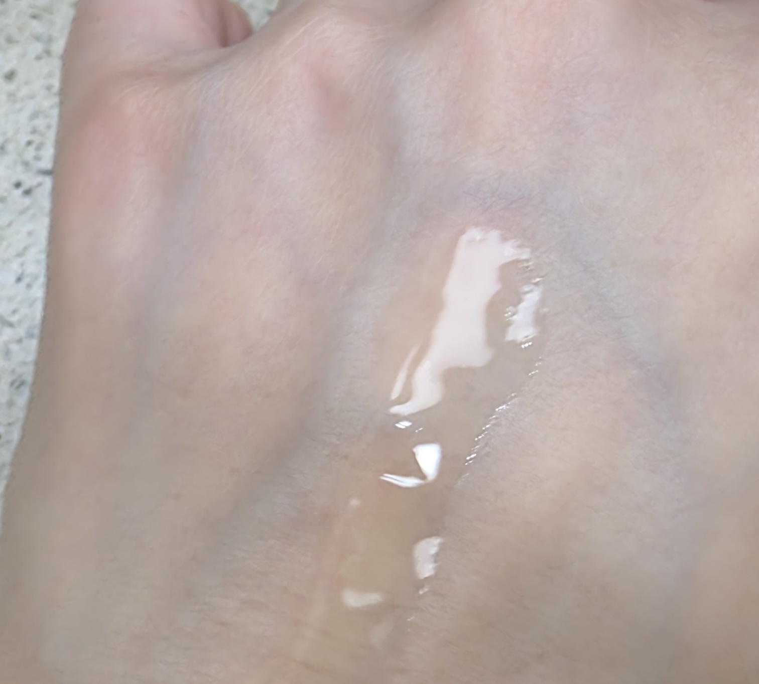 묽은-제형입니다.