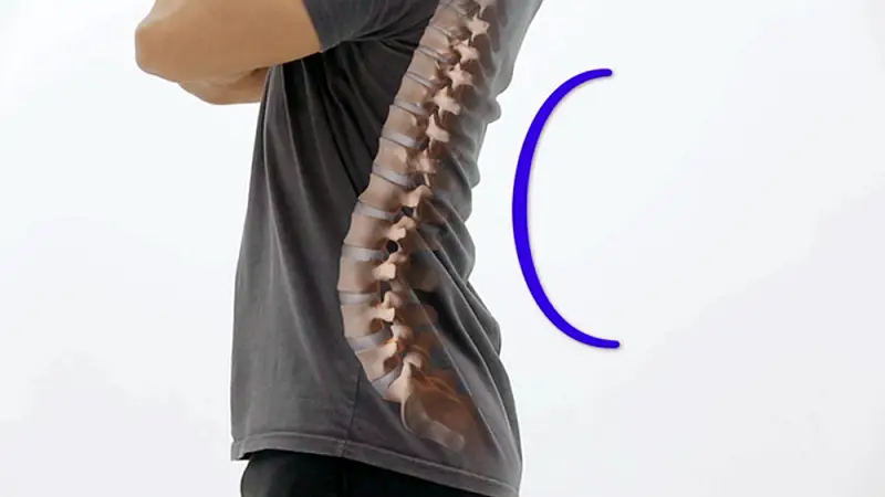 명의 허리통증 치료 통증을 없애는 자세 혁명 치료법 재활의학과 정선근 교수