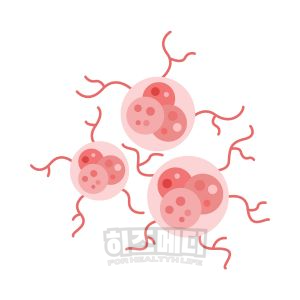 혈색소 수치가 높으면