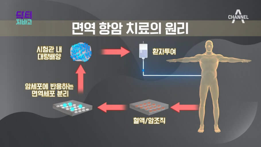 면역항암 치료
