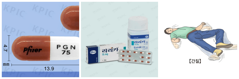 리리카캡슐, 뇌전증 사진